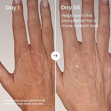 MAELYS B-GLOWY Brightening Body Serum for Dark Spots - Supports Even Looking Skin - Peptide Formula with Niacinamide & Meadowfoam Oil (3.4 Fl Oz)