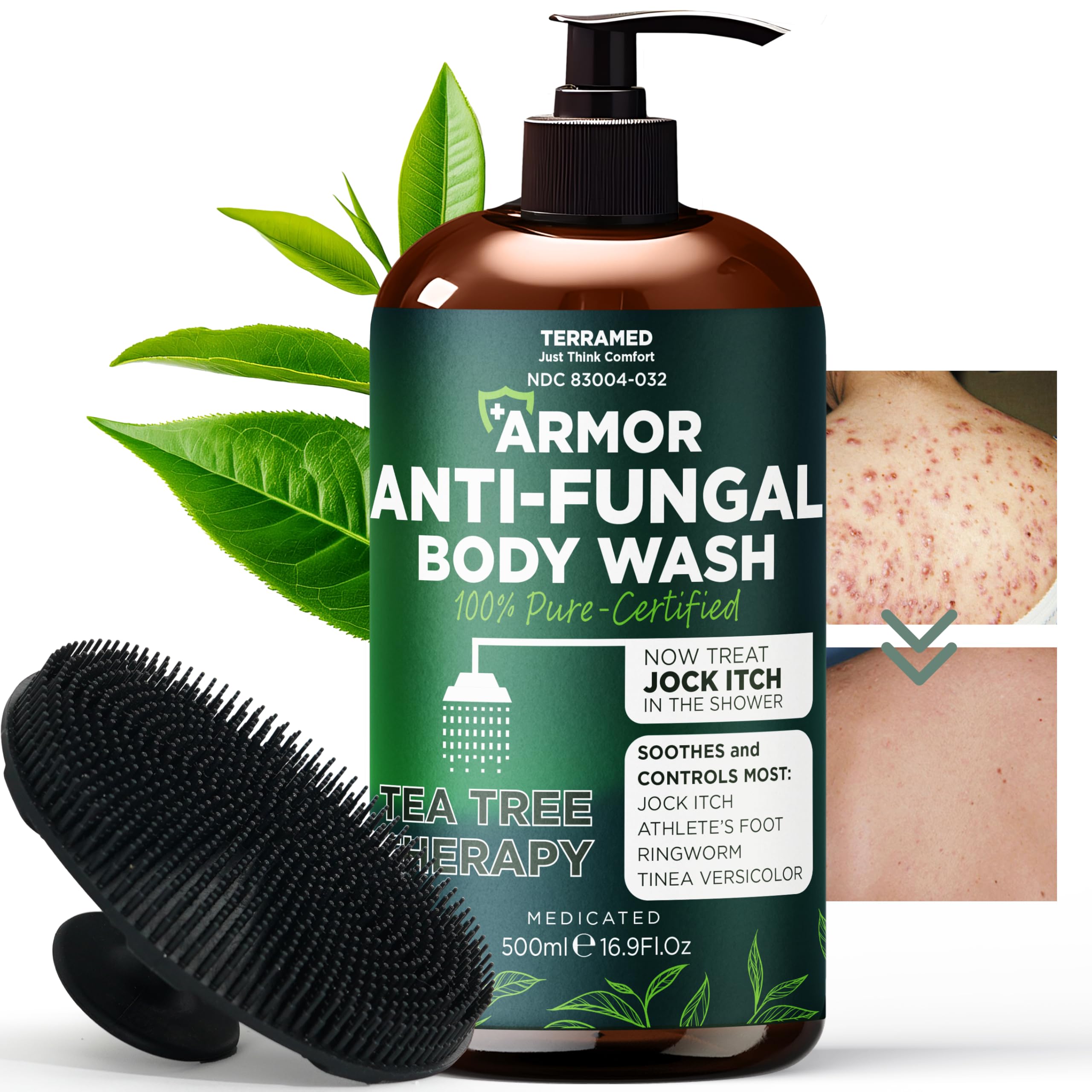 Antifungal Body Wash with Tea Tree Oil | Antibacterial Soap for Back Acne,Treats Ringworm, Eczema & Jock Itch | Antibacterial Body Soap For Men And Women | Includes Silicon Scrubber (16.9 oz)