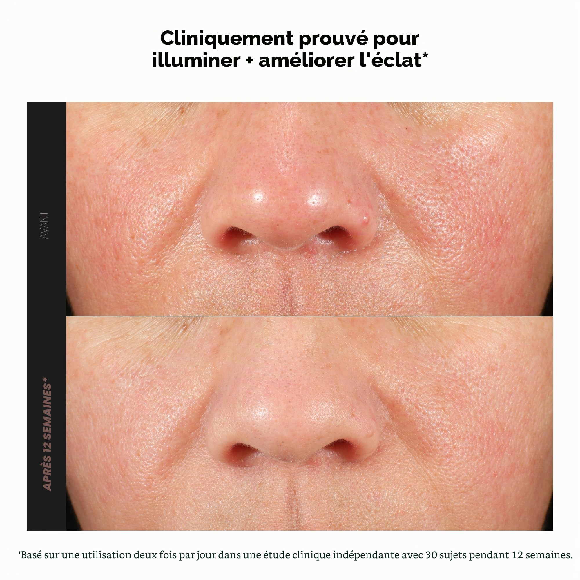 Paula's Choice C15 Vitamine C Super BOOSTER - Anti-Âge Sérum avec 15% Vitamine C - Estompe les Taches Brunes pour une Peau Terne - avec Acide Férulique - Tous Types de Peaux - 20 ml