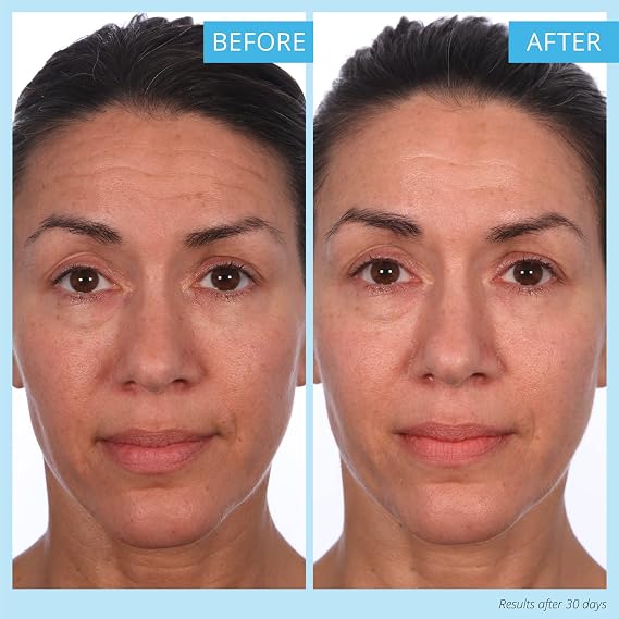 SKINN Creme Reverse with Ferulic Acid, Retinol and Vitamin C-Creme Reverse Intensive-Anti-Aging Cream with Hyaluronic Acid to Plump Skin Vitamin C Help to Improving Tone, Firmness of Skin