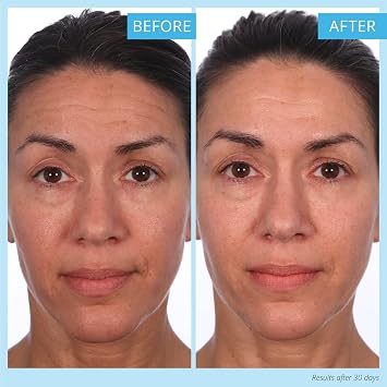 SKINN Creme Reverse with Ferulic Acid, Retinol and Vitamin C-Creme Reverse Intensive-Anti-Aging Cream with Hyaluronic Acid to Plump Skin Vitamin C Help to Improving Tone, Firmness of Skin