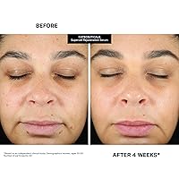 Vista 11 de Kate Somerville KateCeuticals® SuperCell - Suero peptídico de rejuvenecimiento para reparar la piel dañada y reducir líneas finas y arrugas, 1 onza