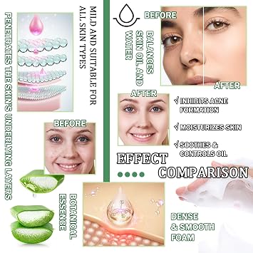 Skin Care Kit,Skincare Gift Set with Facial Cleanser,Toner,Serum,Eye Cream, Face Cream,Exfoliating Gel,Sleeping Lip Mask & 3 Pcs Aloe Vera Mask Kit for Women(10 Count)