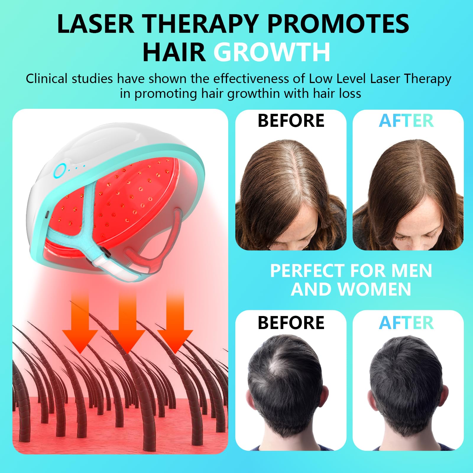 iKeener Système Croissance Cheveux Laser-Traitements Perte Cheveux Approuvés FDA pour Hommes et Femmes,Produits Croissance aux Cheveux Clairsemés,Repousse Cheveux Casque Laser,Thérapie Lumière Rouge