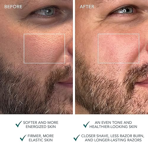 Miniatura 5 de FOREO LUNA 4 Cepillo de limpieza facial  Masajeador facial reafirmante  Cuidado facial antienvejecimiento  Mejora la absorción de productos para el