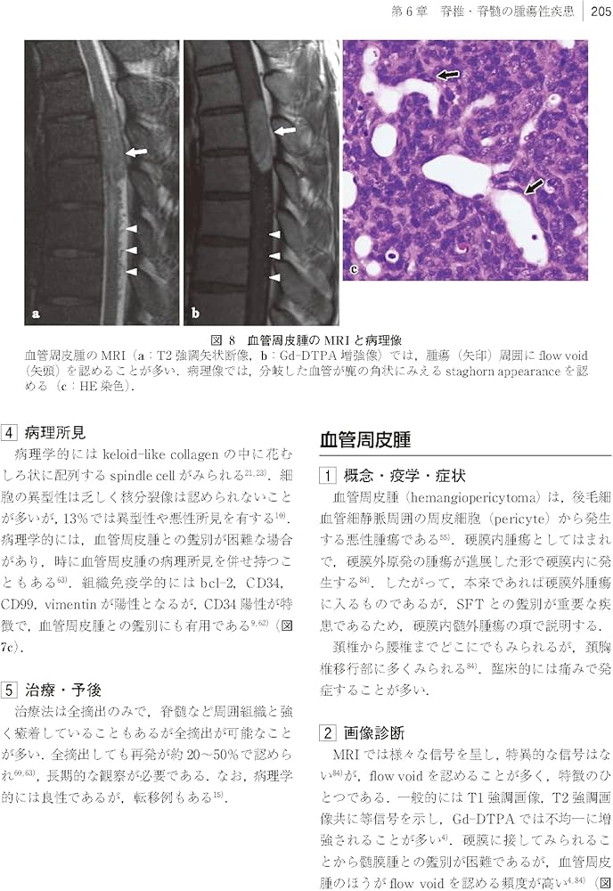 Amazon.co.jp: 脊椎・脊髄疾患の外科 第2版 : 飛驒一利, 小柳 泉