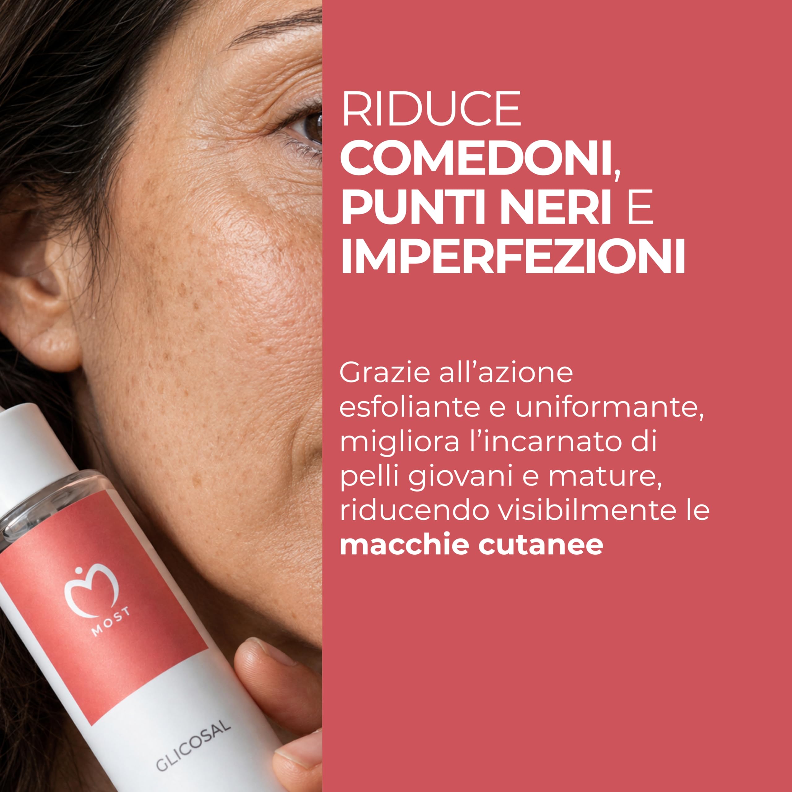 MOST - Glicosal Esfoliante Viso Micropeeling, Lozione con Acido Salicilico e Acido Glicolico - Delicata Azione Peeling Viso e Anti Macchie, Pelle a Tendenza Acneica, Impura, Melasma, Imperfezioni 50ml