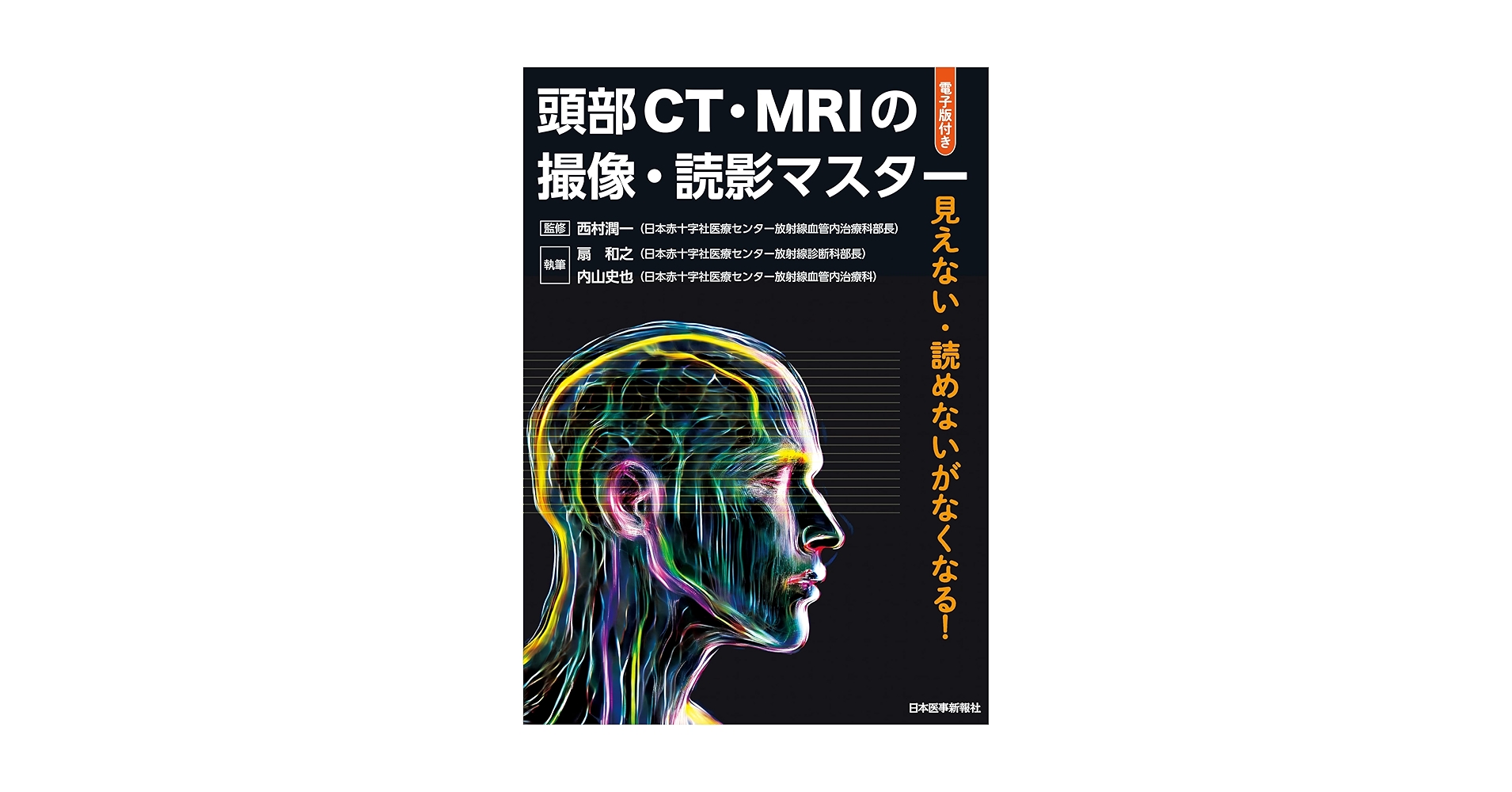 MRI & CT 一問一答セット MRI一問一答: 撮像法選択と読影に“必ず”役立つ基礎知識 | 平井