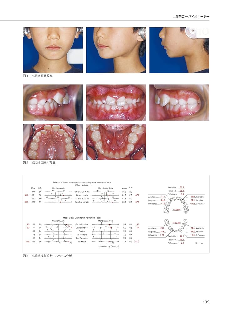 ☆彡裁断済 矯正歯科治療 この症例にこの装置 第2版 矯正歯科治療 この症例にこの装置 第2版／医歯薬出版株式会社