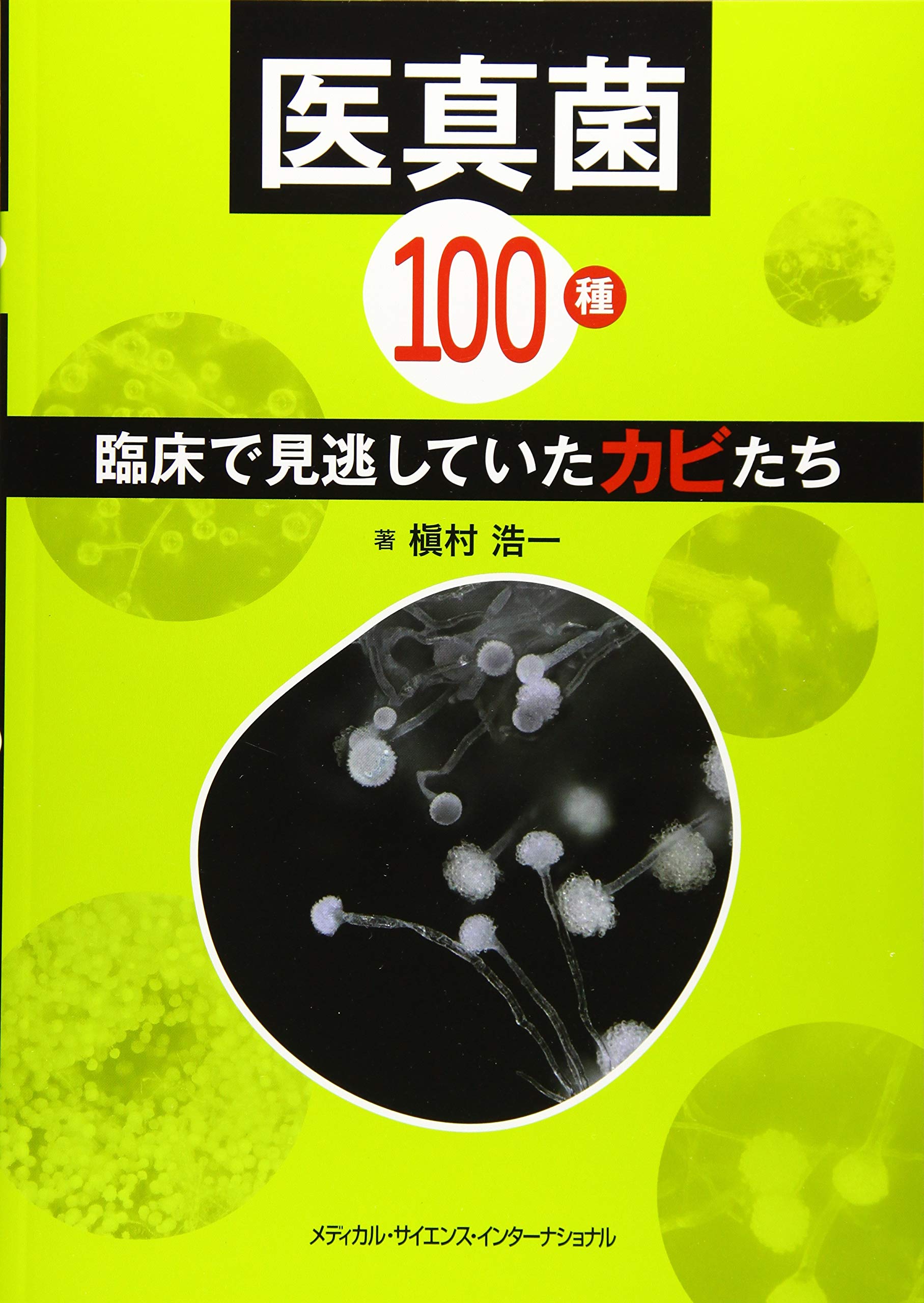 医真菌100種 臨床で見逃していたカビたち | 槇村浩一 |本 | 通販 | Amazon