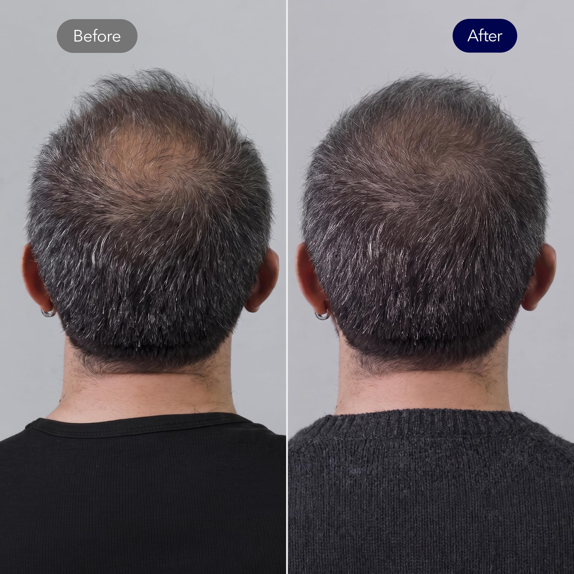 ViveLab Biotin Shampoo with Peptides for Thinning Hair