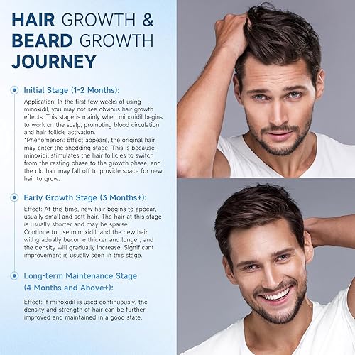 Miniatura 6 de 5% de minoxidil para el crecimiento del cabello de hombres y mujeres, spray de minoxidil para suero de crecimiento de barba, combate