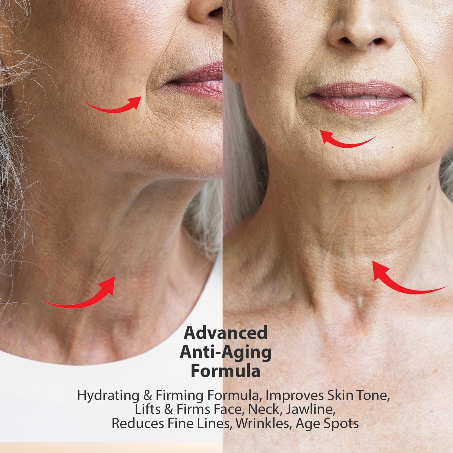 UOG Sérum facial com super vitamina C (United One) – fórmula antienvelhecimento, hidratante e firme, levanta e firma o rosto, pescoço, mandíbula, reduz manchas escuras, linhas… em promoção! Veja a oferta e mais achadinhos de Vitaminas & Suplementos 6 Hoje é o melhor dia para comprar UOG Sérum facial com super vitamina C (United One) – fórmula antienvelhecimento, hidratante e firme, levanta e firma o rosto, pescoço, mandíbula, reduz manchas escuras, linhas… com aquele preço maroto! Promoção! Aproveite a oferta! 6