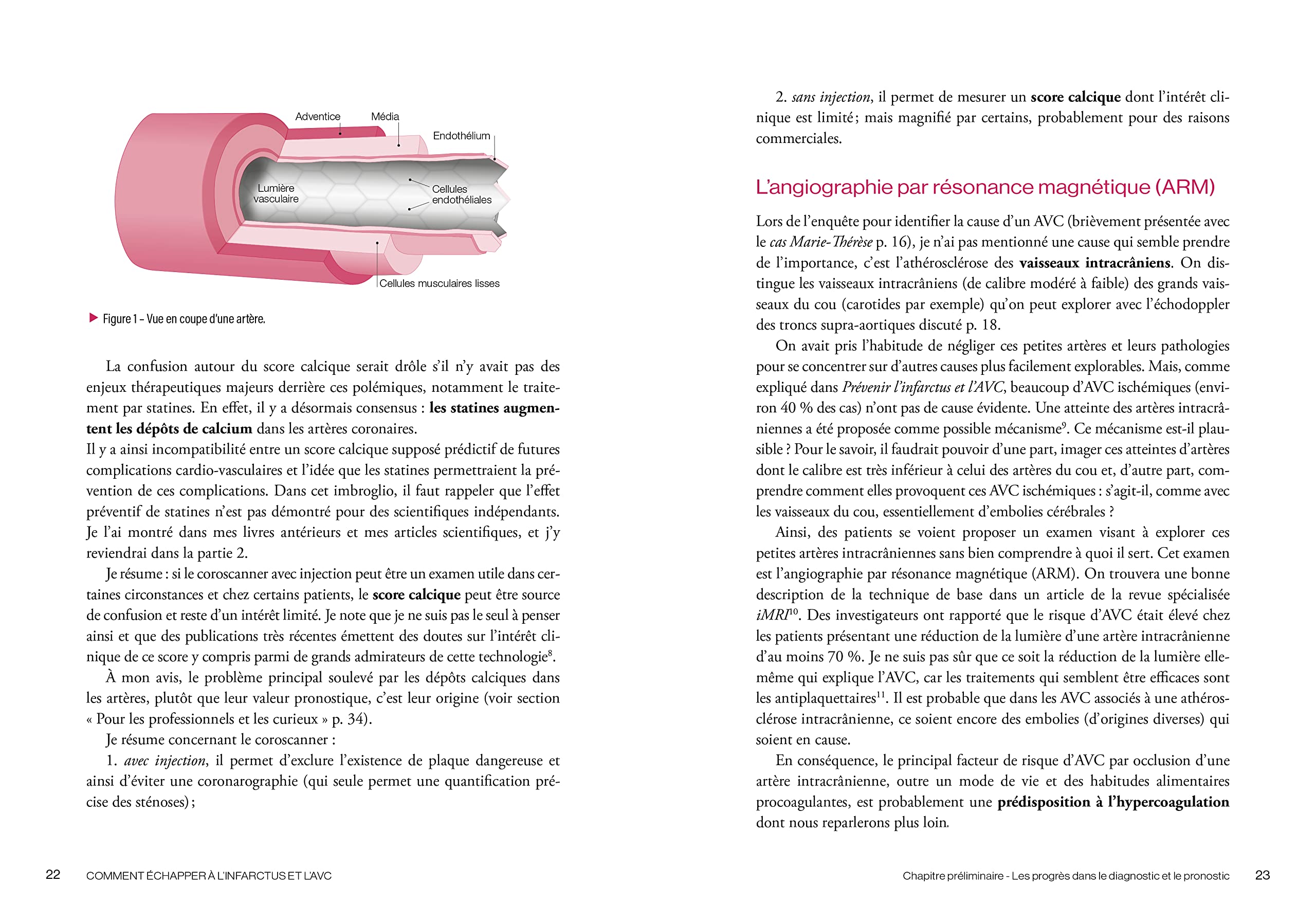 Comment échapper à l'infarctus et l'AVC