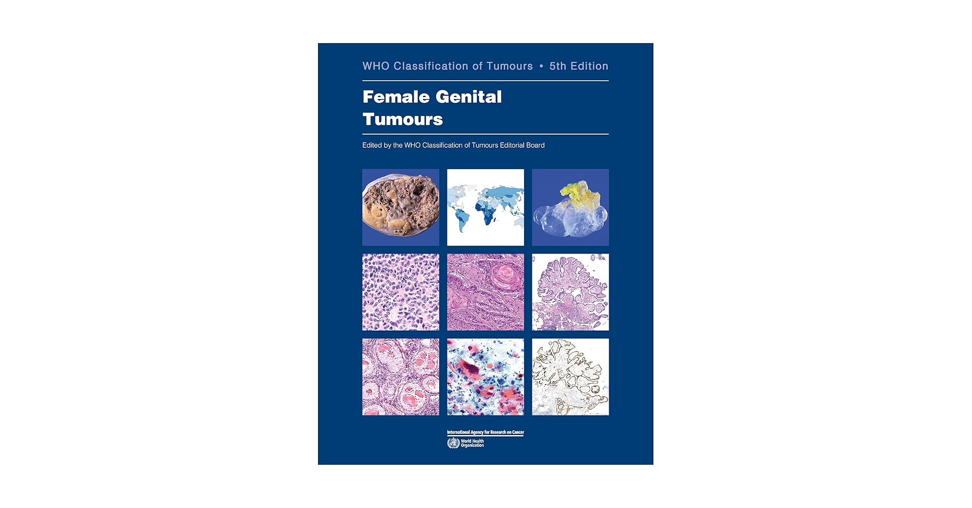 Female Genital Tumours: WHO Classification of Tumours