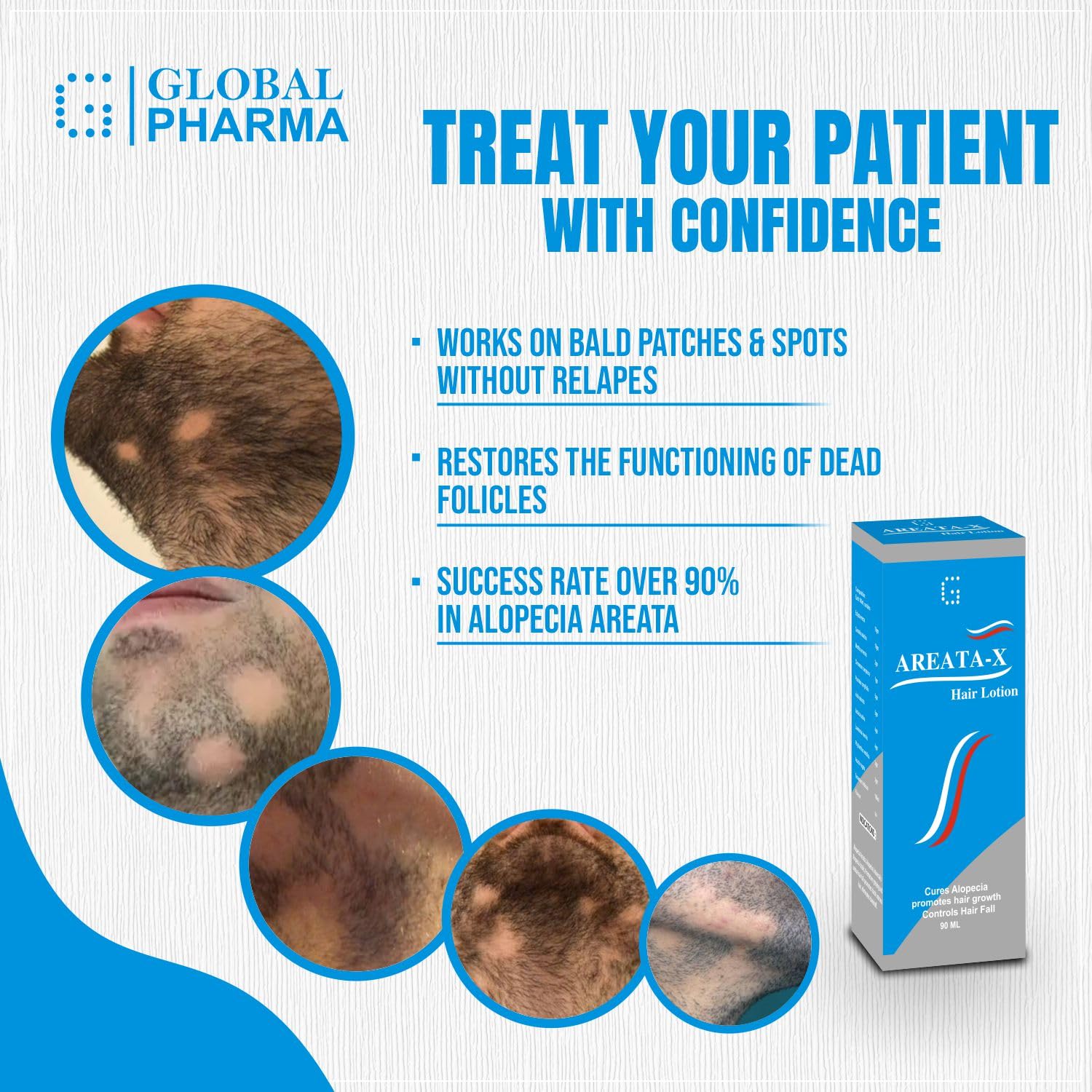 Discover 146+ hair loss kyu hota hai best tnbvietnam.edu.vn