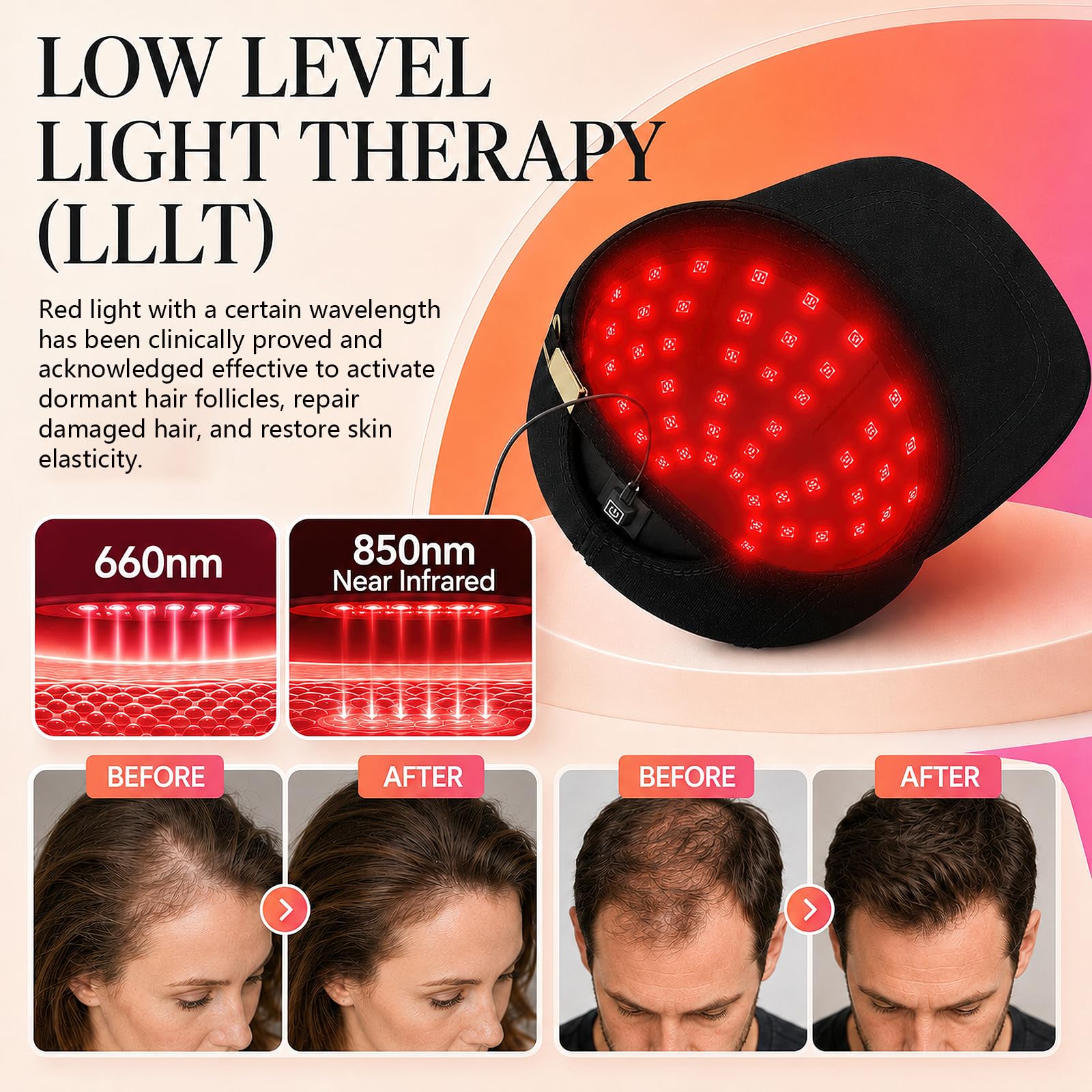 Rotlichttherapie Kappe für Haarwachstum, Kombination aus 660nm und 850nm Rotlicht, Haarwuchs-Kappe für den Heimgebrauch für Männer und Frauen