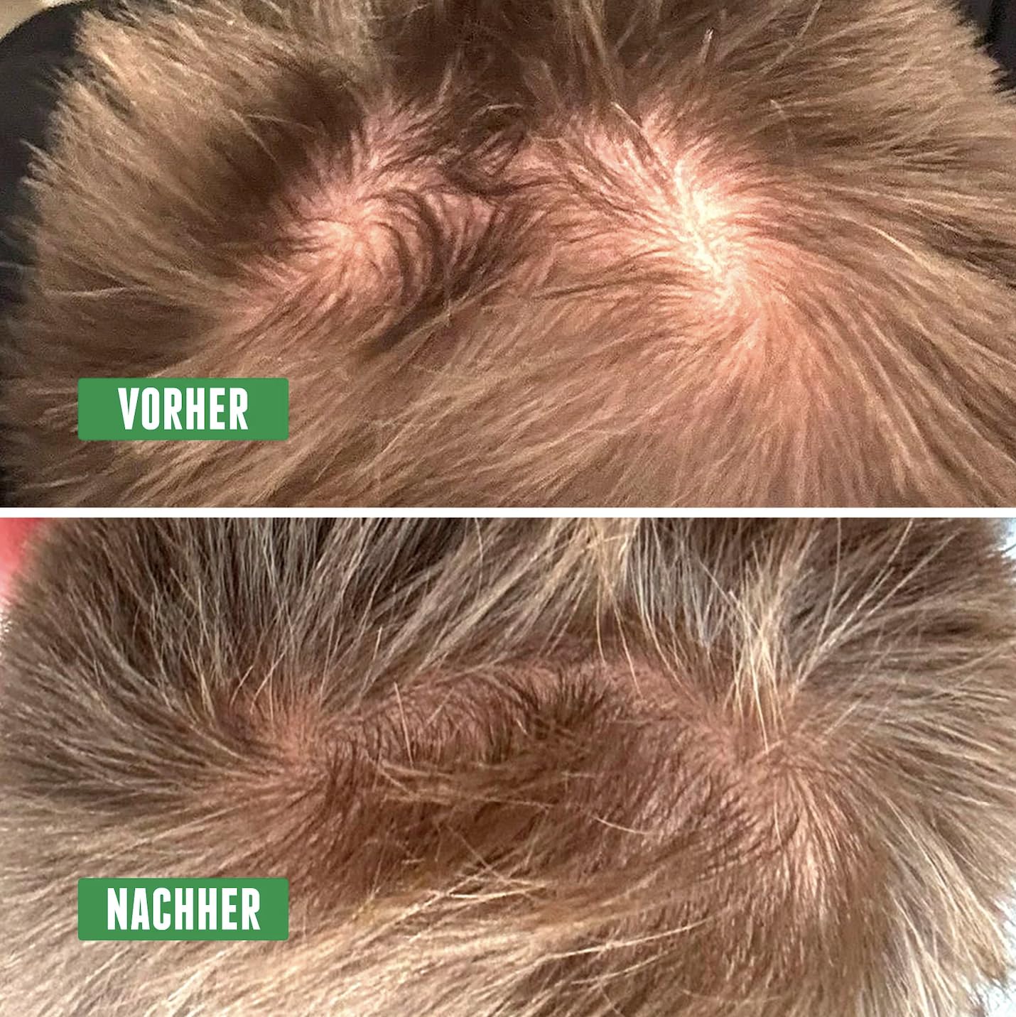 Activator Hair Bundle · BROOKLYN SOAP COMPANY - 2-Schritte-Routine | gegen Haarausfall, Mit Shampoo & Tonic für verbessertes Haarwachstum, Für sichtbar kräftigeres, dichteres Haar