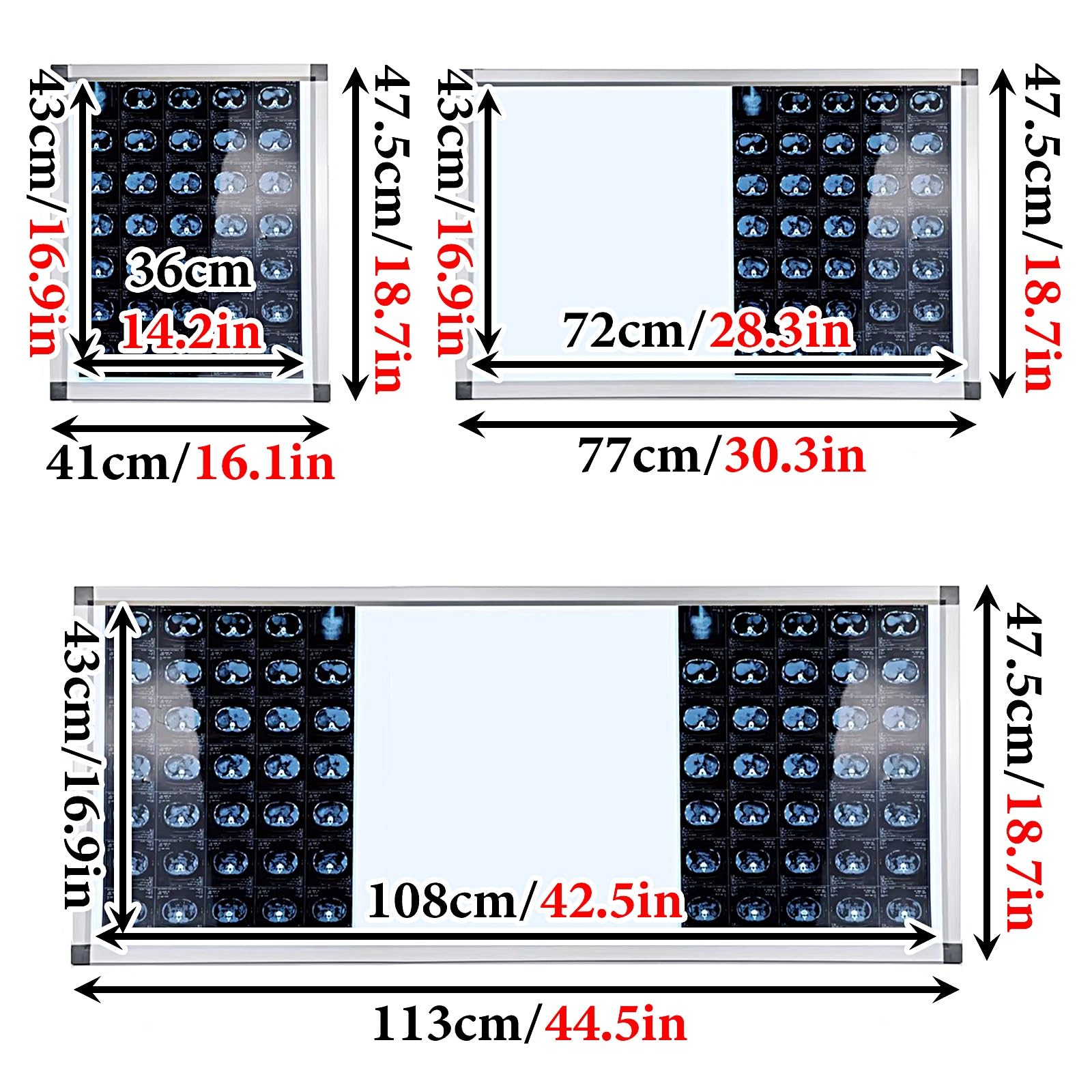 Lampada a LED per Pellicole Radiografiche Visore per Pellicole per Apparecchiature Mediche Telaio in Alluminio e Pannello in Acrilico per Cliniche e Ospedali(41x47.5x1.3cm/16.1x18.7x0.5in)