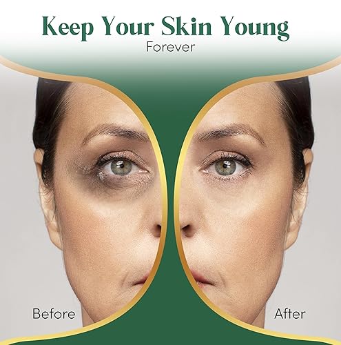 Miniatura 3 de Parches para debajo de los ojos de oro de 24 quilates para ojos hinchados (12 pares envueltos individualmente), máscaras enriquecidas con colágeno