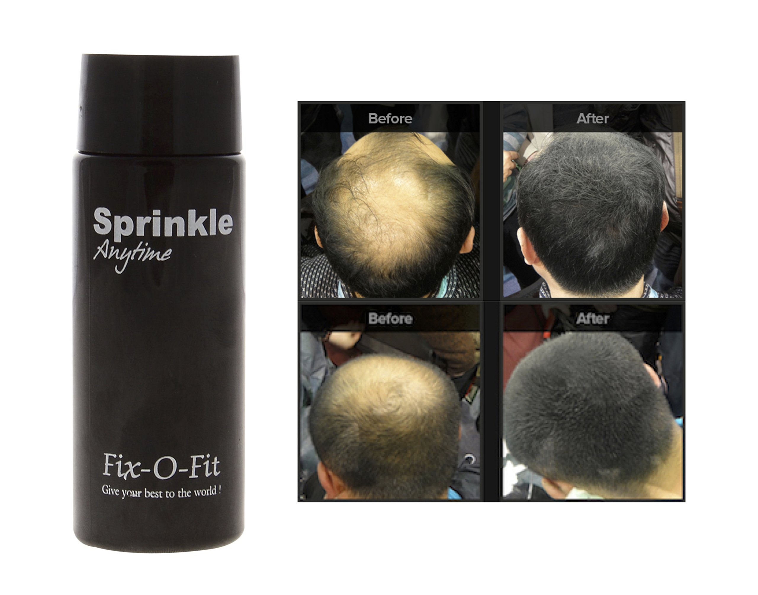 Hair Building Fibers | Instant Hair Thickening & Bald Spot Concealer | Natural Finish, Easy to Apply, Wind & Sweat Resistant (Dark Brown, 8g (Pack of 1))