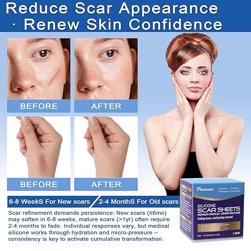 Miniatura 6 de Hojas de silicona para cicatrices y cinta para sustos quirúrgicos, sección C, abdominoplastia  Tiras de tratamiento de golpes queloides  Rollo de