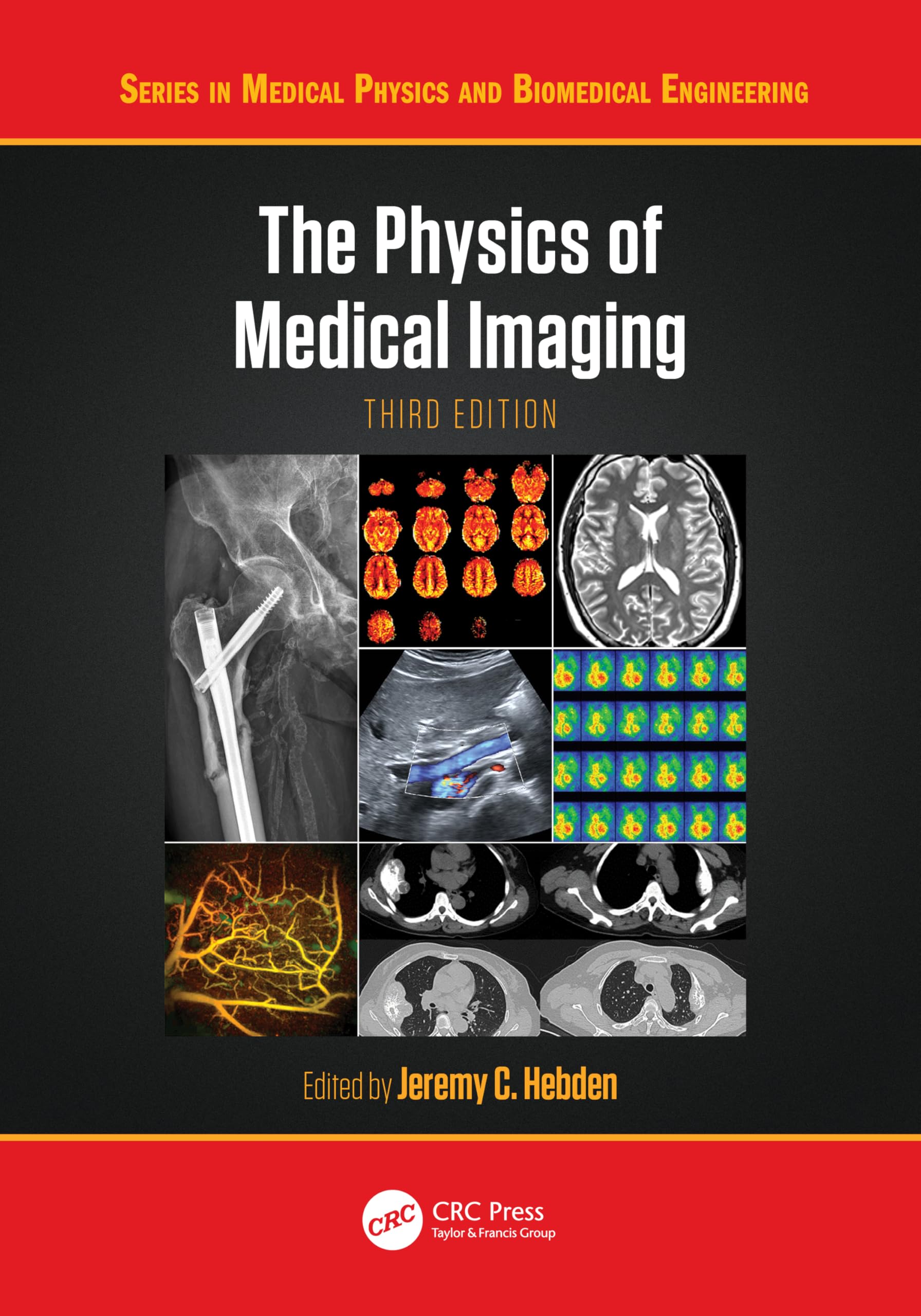 The Physics of Medical Imaging (Series in Medical Physics and Biomedical Engineering)