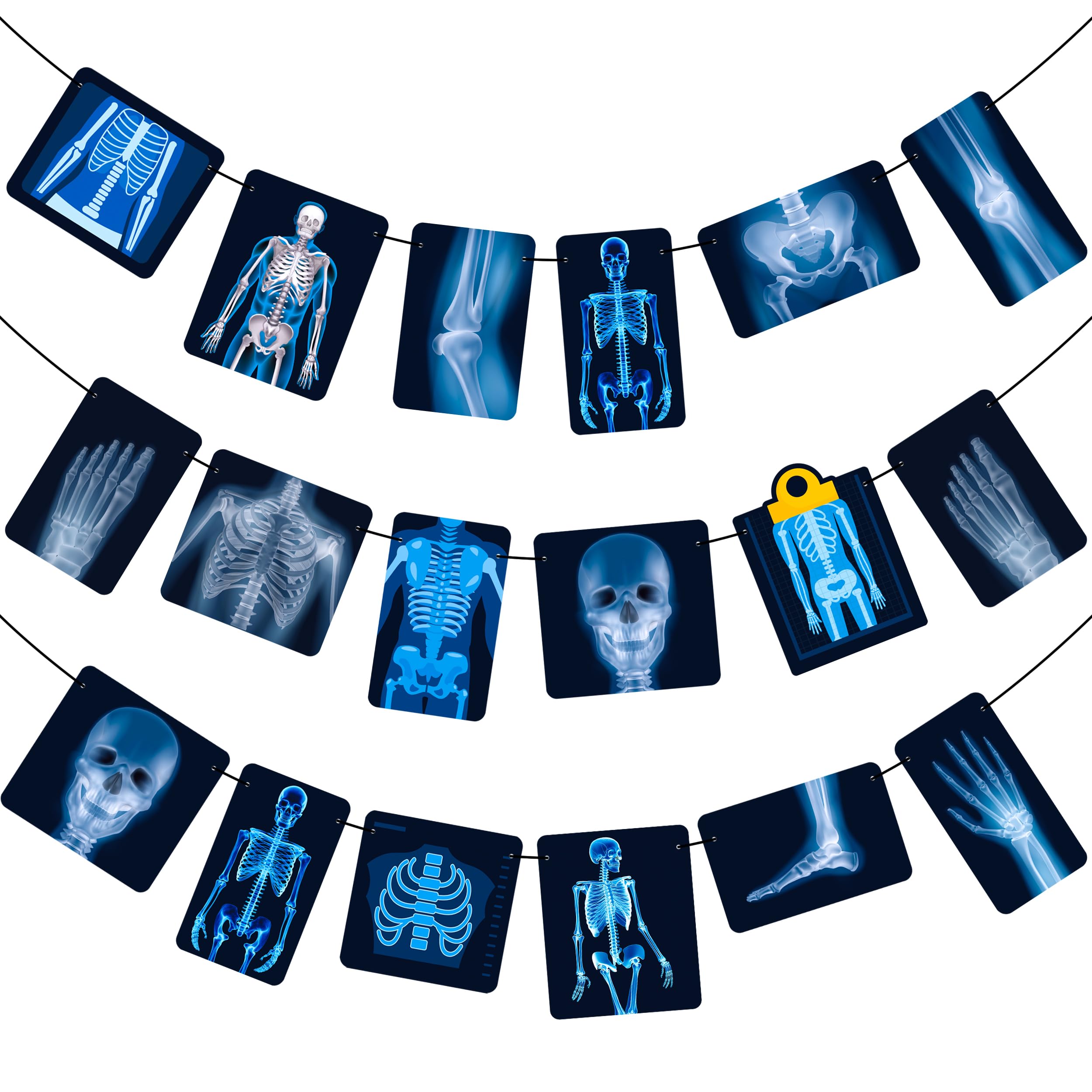Radiology X Ray Theme Banners Radiology Birthday Party Decorations X Ray Party Banner Garlands for Radiology Doctor Birthday Party X Ray Medical Theme Party Baby Shower Supplies