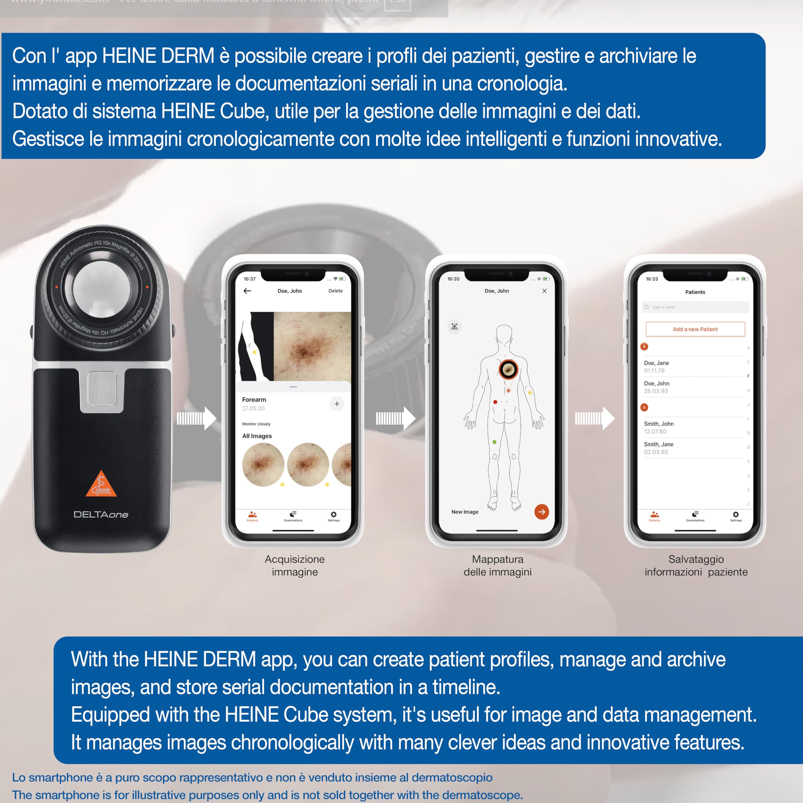 HEINE - Dermatoscopio Deltaone tascabile per esame della cute, nero