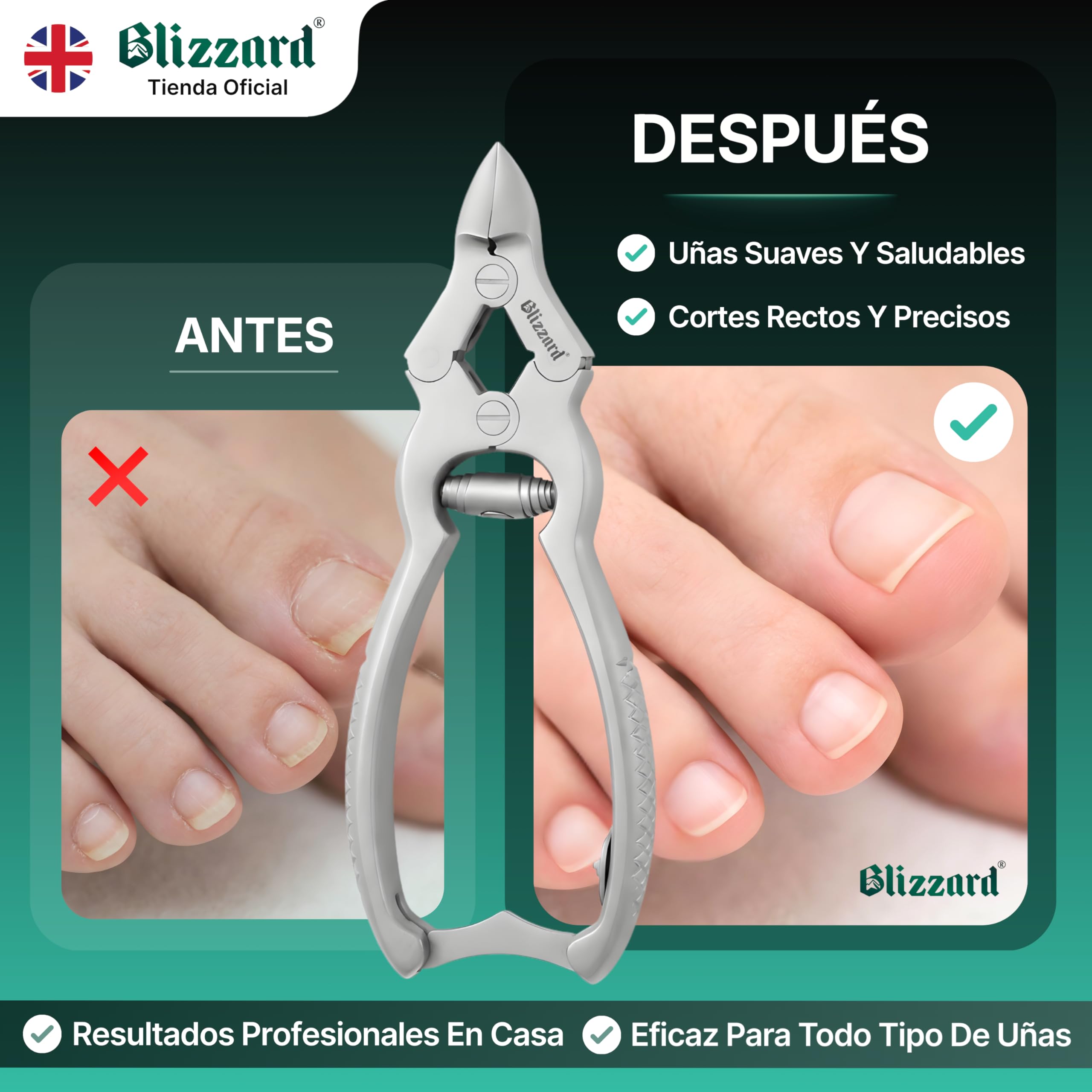Blizzard Alicates Cortauñas Profesional para Pies - Corta Uñas de Alta Resistencia Triple Articulación para Uñas Gruesas y Encarnadas Acero Inoxidable Grado Podología con Lima - 15cm Resorte Espiral