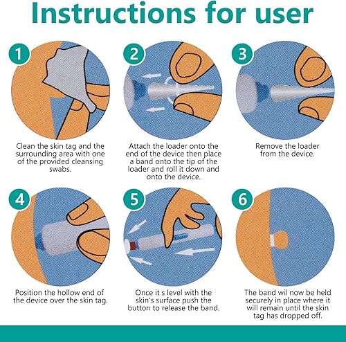 Miniatura 4 de cenlomat Removedor de verrugas para perros, kit de eliminación de verrugas de perro de acción rápida, seguro y fácil de usar, resultados en unos