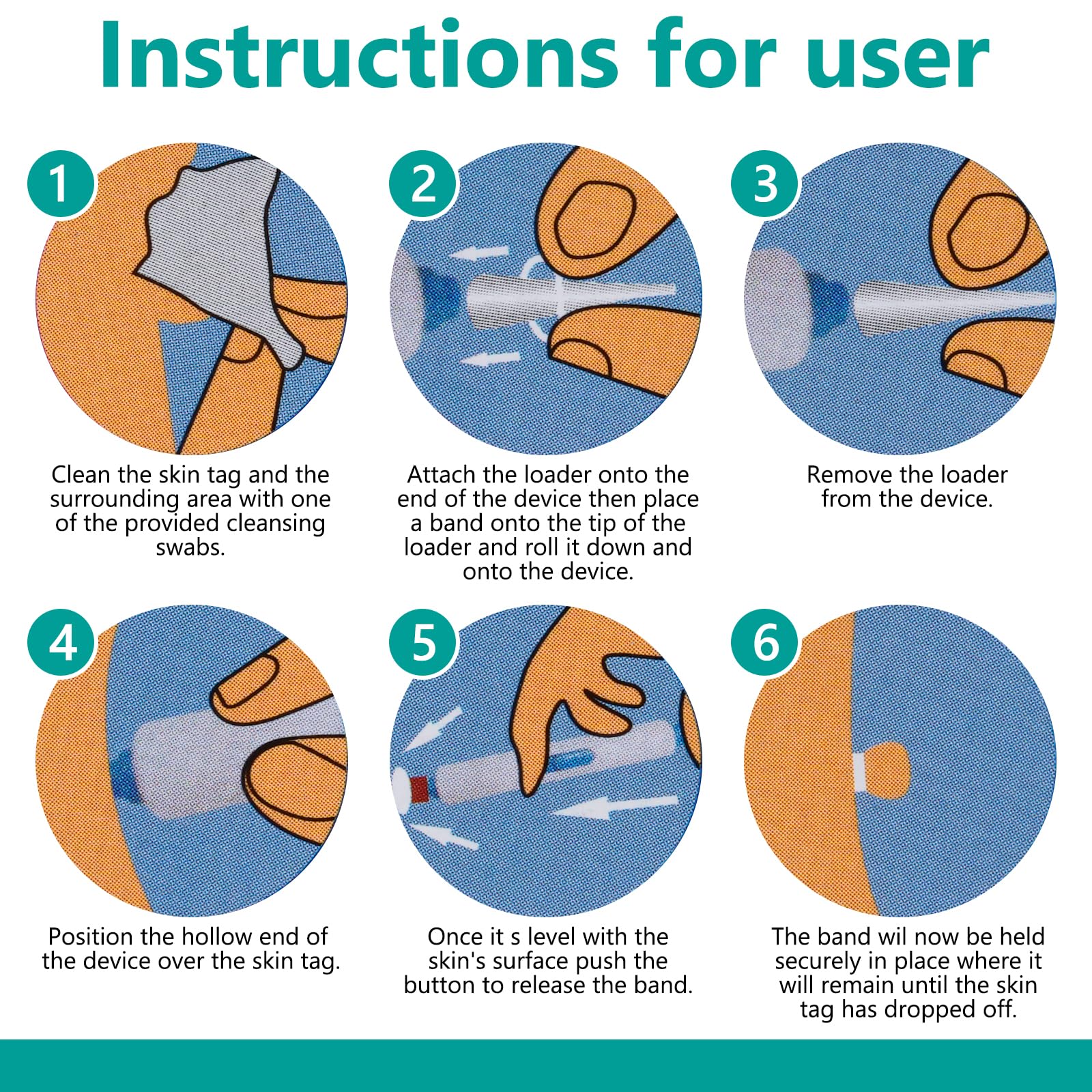komxsum dog wart remover fast acting dog wart removal treatmentsafe and easy to use does not get into the skin