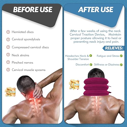 Miniatura 6 de Jaximy Ensanchador de cuello, dispositivo de tracción cervical, dispositivo de tracción cervical, alivio del dolor de cuello, soporte inflable