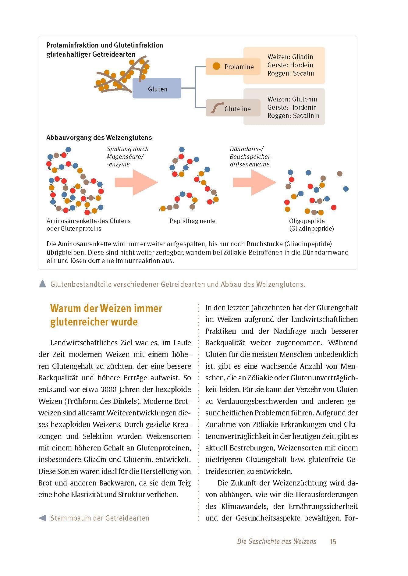Zöliakie: Erkrankung verstehen, Gluten meiden, Ernährung anpassen, Therapiemöglichkeiten
