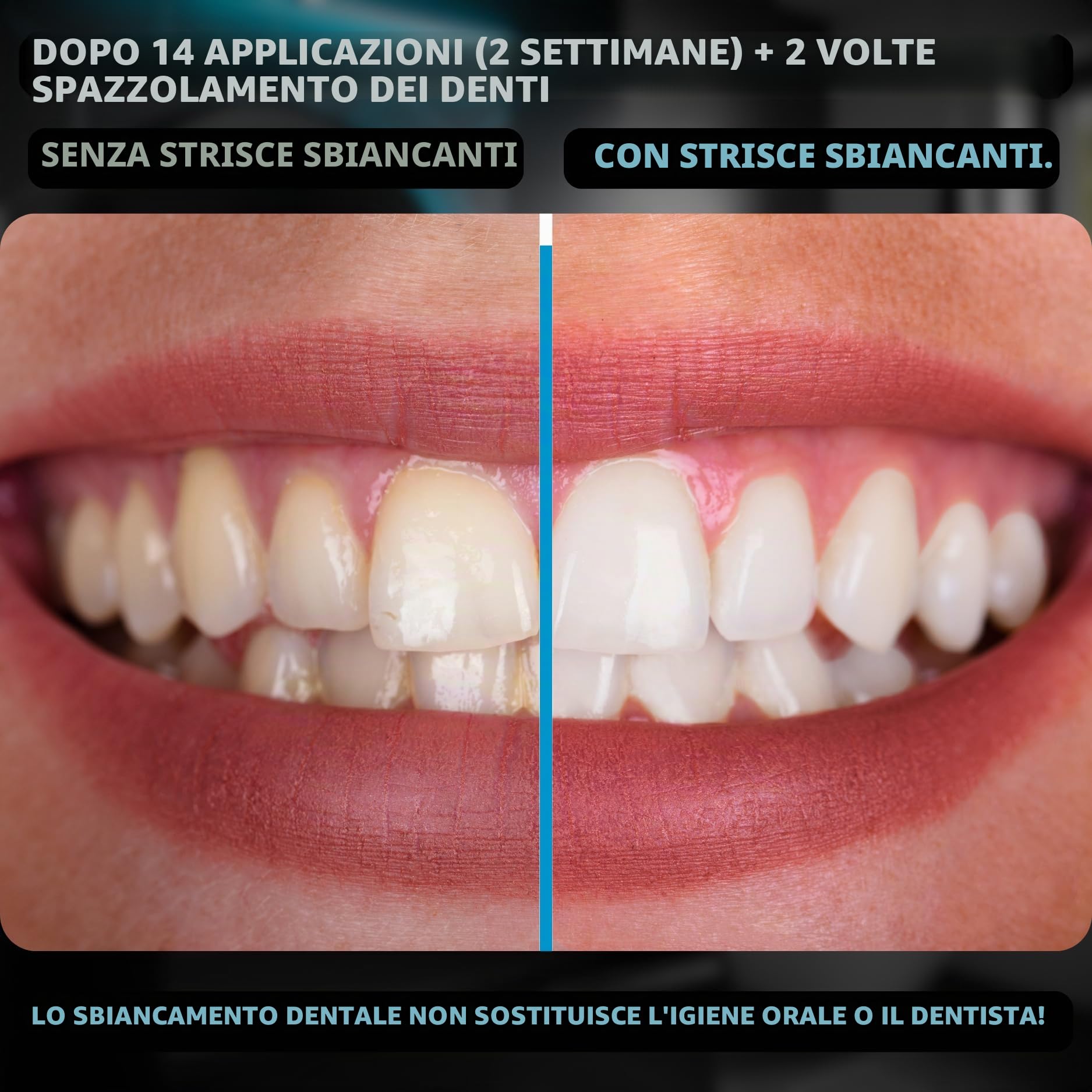 Le strisce sbiancanti | Strisce sbiancanti dei denti (28 strisce) per denti extra bianchi | Strisce sbiancanti denti professionali | Formula 2025 Pure White | Trattamento Teeth Whitening Express con