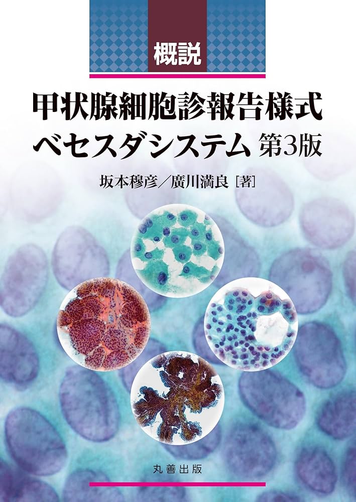 甲状腺癌 (腫瘍病理鑑別診断アトラス) 坂本穆彦; 廣川満良 甲状腺癌 (腫瘍病理鑑別診断アトラス) | 坂本穆彦, 廣川満良 |本