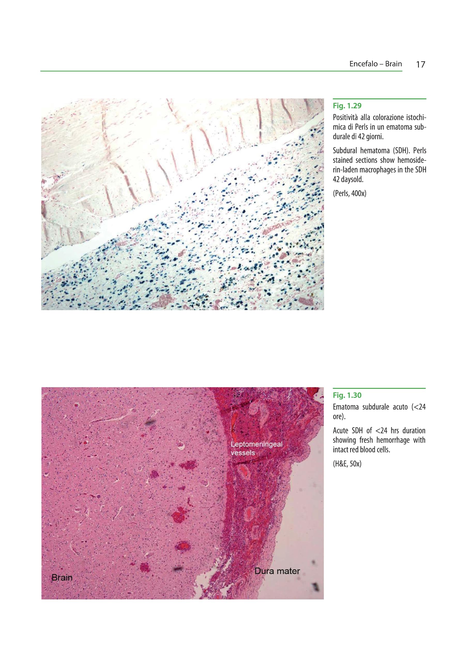 Atlante di istopatologia forense-Atlas of forensic histopathology. Ediz. bilingue