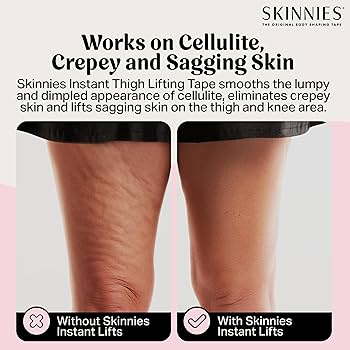 Lift Before And After Loose Skin On Thighs Before And After Weight