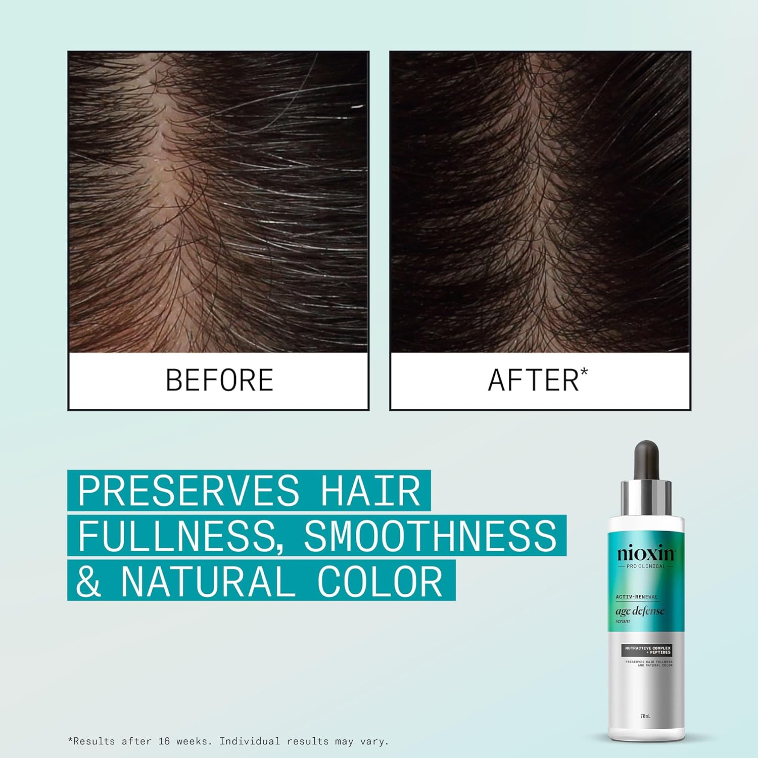 Nioxin Age Defense Anti Aging Kit | Activ-Renewal Regimen Detox Scalp Cleanser, Strengthening Conditioner, Leave-in Scalp Treatment | 5.5 Fl Oz - Image 6