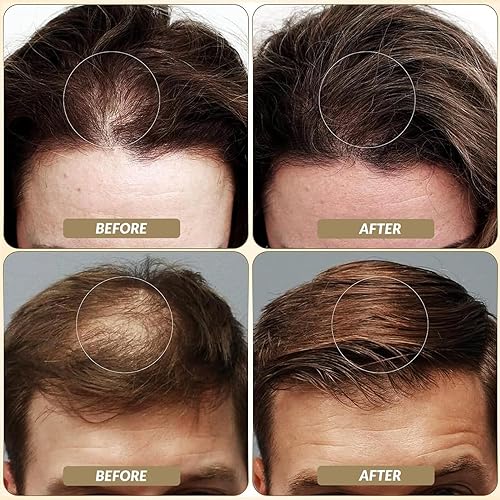 Miniatura 3 de SOVONCARE Fibras capilares para cabello fino rubio medio, fibras de construcción de cabello para puntos calvos, indetectables y naturales, oculta la