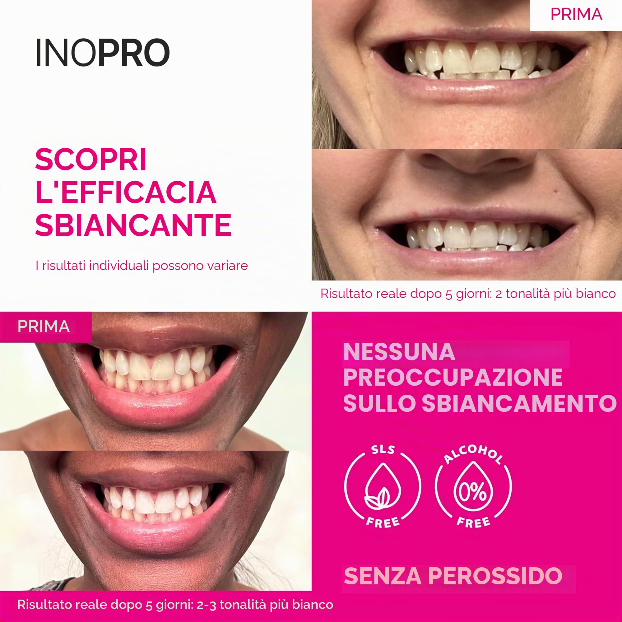 InoPro - Il verde è il nuovo bianco. Le nostre strisce sbiancanti sbiancano efficacemente i denti senza danneggiare la salute orale. Le nostre strisce sbiancanti verdi hanno una rimozione delle
