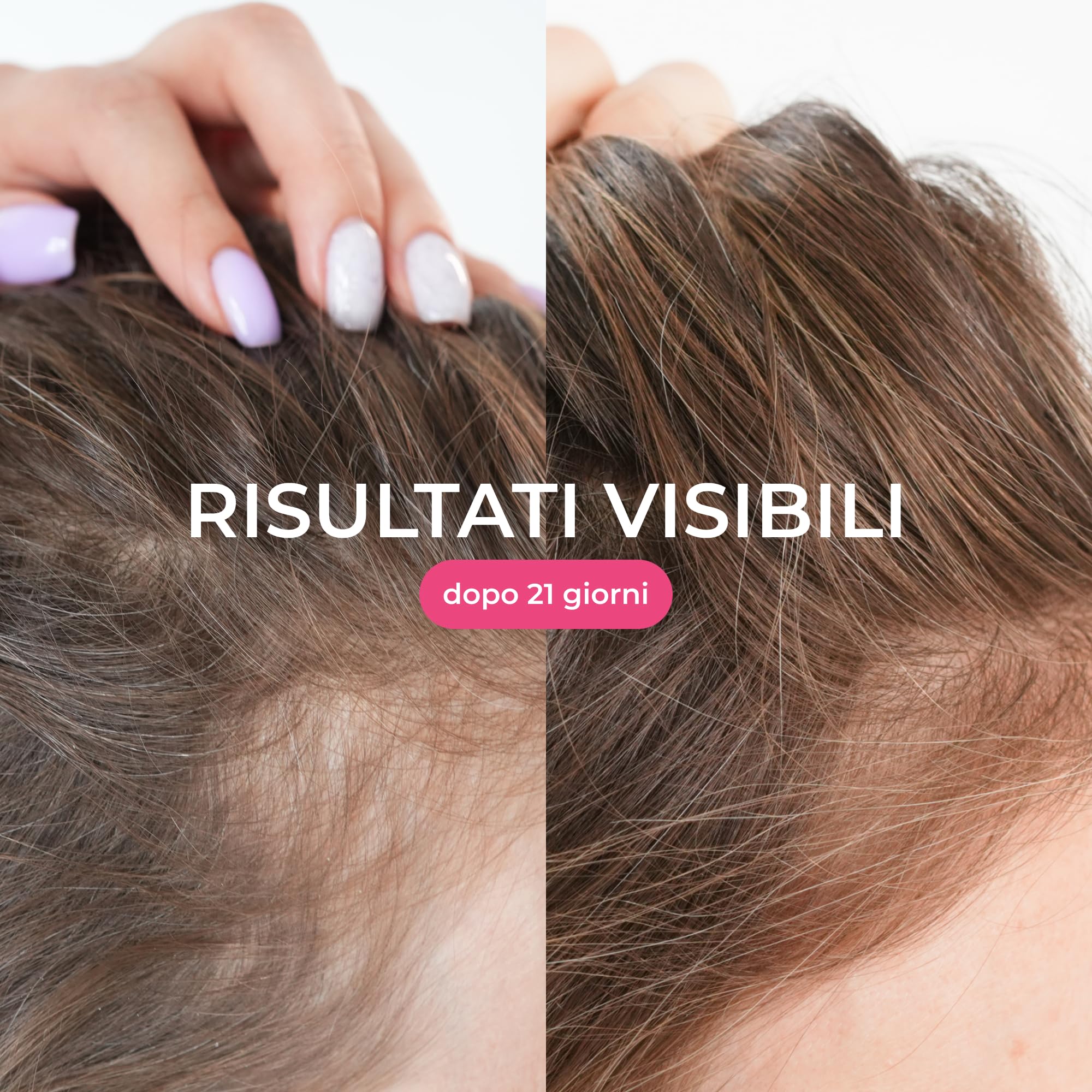 COCOSOLIS GROW Crescita Capelli Siero Spray - Crescita Capelli veloce Donna Оlio Capelli (110ml)