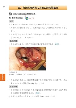 新口腔病理学 新口腔病理学 第3版/医歯薬出版株式会社