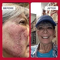 Vista 6 de Pomada de primeros auxilios, Emuaid Max, de 2 onzas, 2, 1