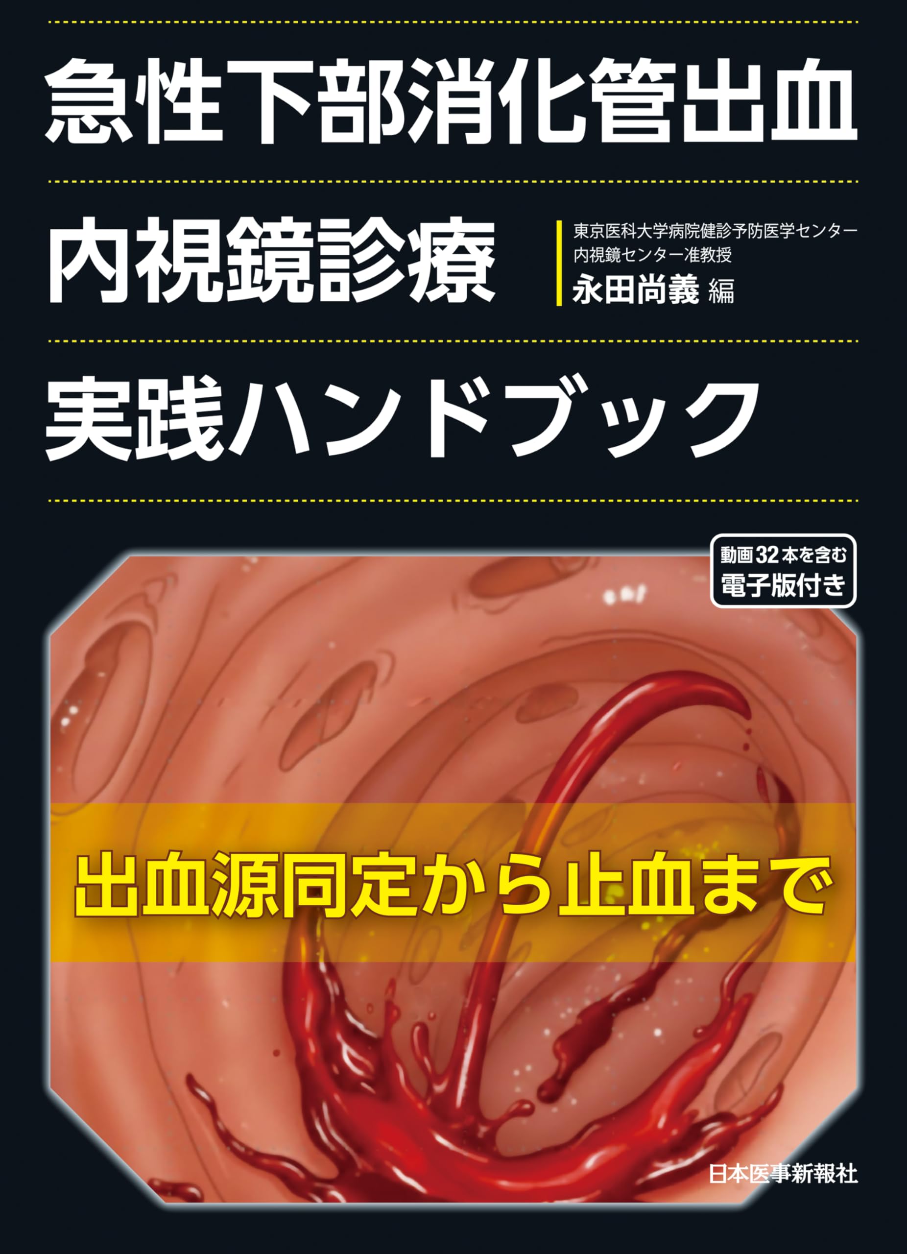 急性下部消化管出血 内視鏡診療実践ハンドブック | 永田尚義 |本