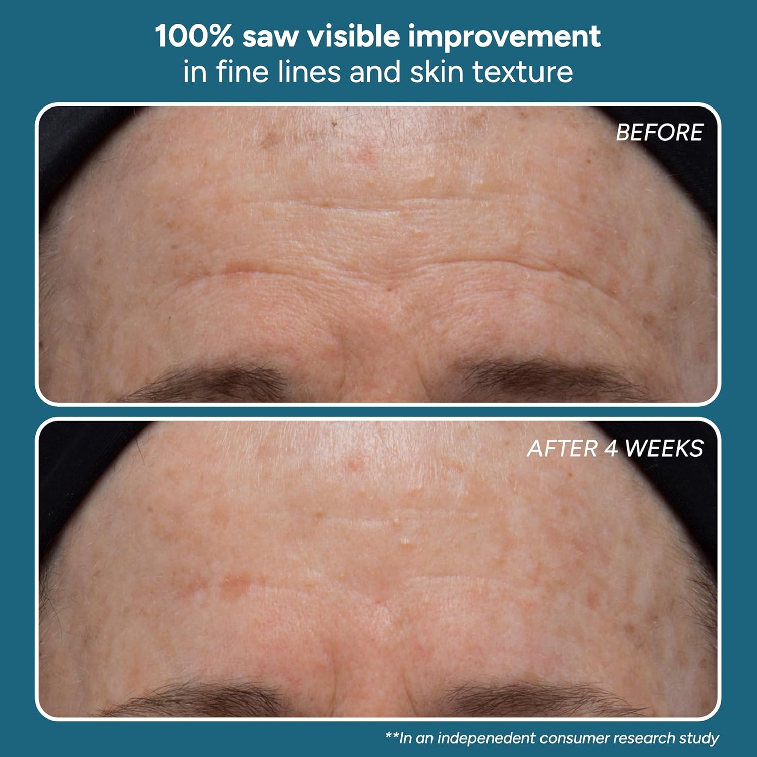 Lancer Skincare The Method: Cleanse Face Cleanser, Daily Face Wash with Salicylic Acid, Sensitive or Dehydrated Skin, 4.05 Fluid Ounces - Image 3