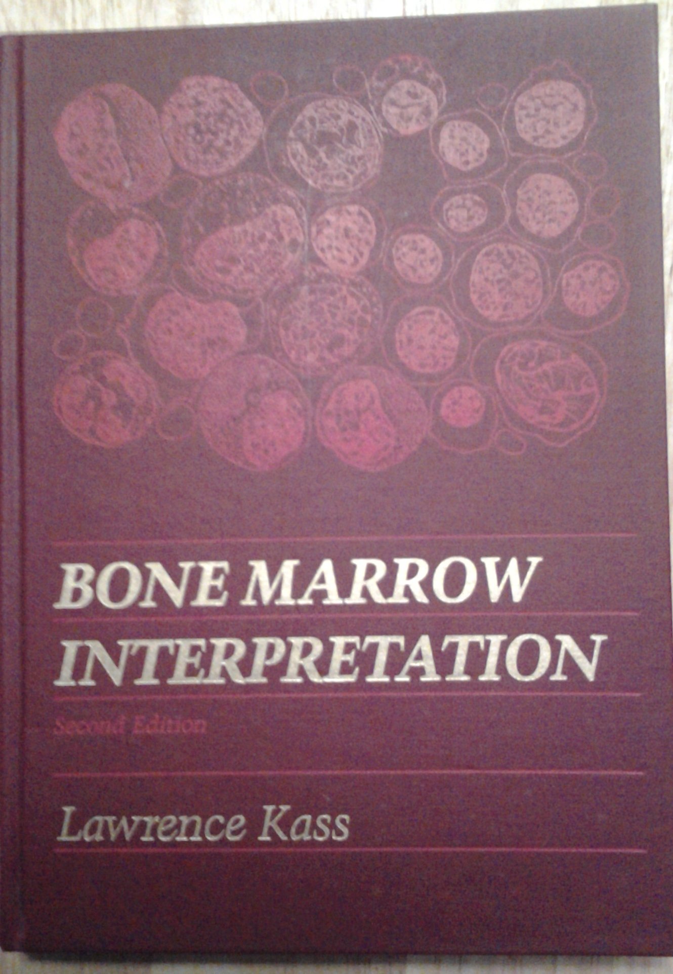 Bone Marrow Interpretation