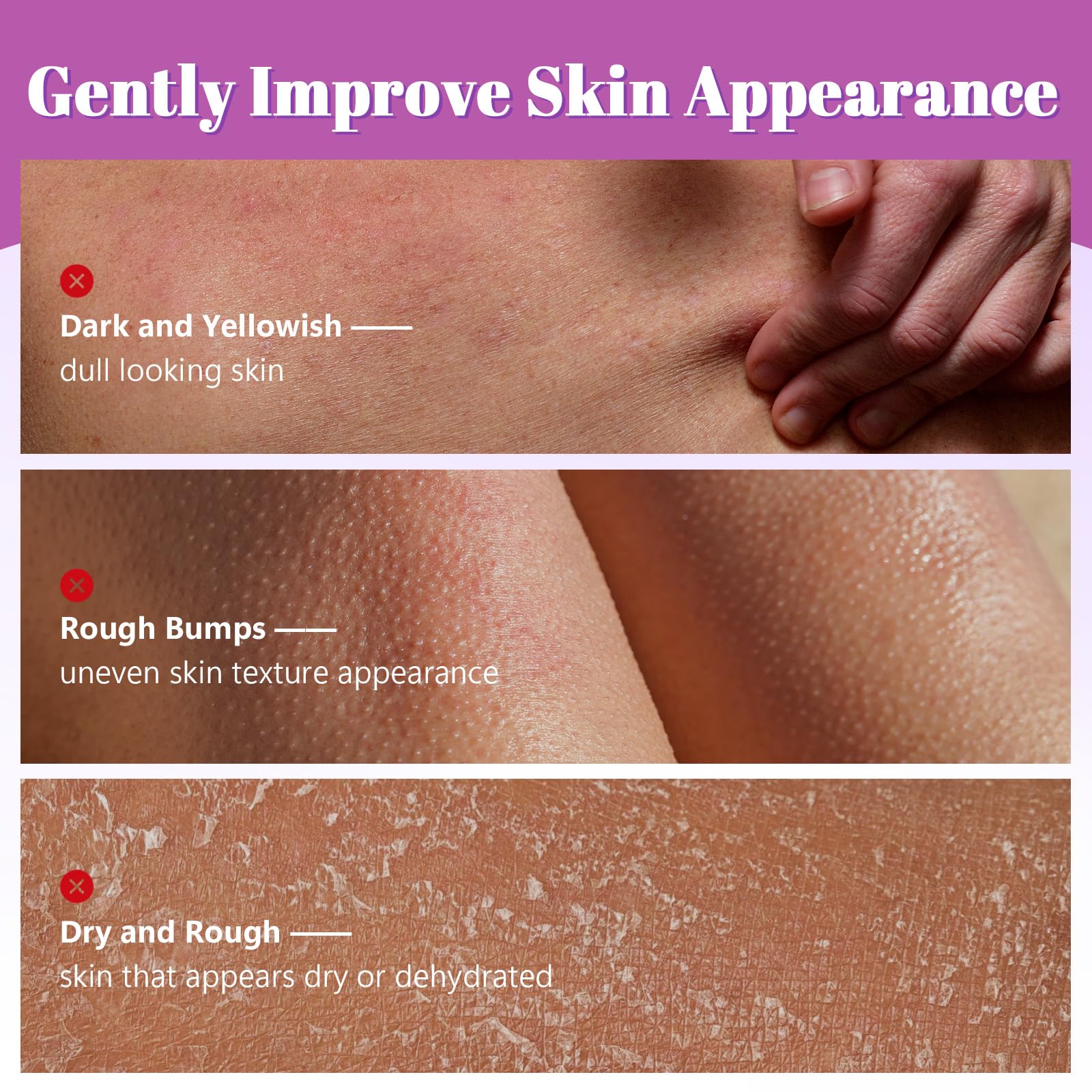 Bâton Exfoliant Pour Le Corps À L'Acide Glycolique 75 G, Avec 7% D'Acide Glycolique + 0,5% D'Acide Salicylique, Aha Et Bha Améliore La Peau Rugueuse, Les Pores Obstrués, La Peau D'Orange
