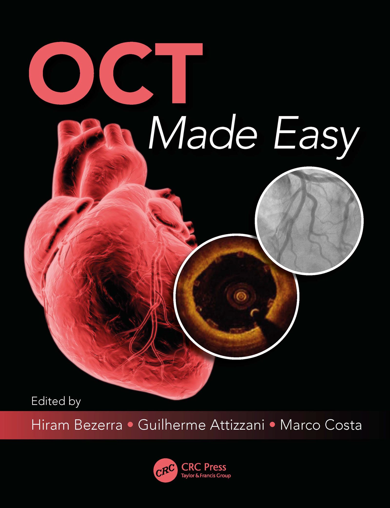 OCT Made Easy (English Edition)