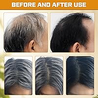 Vista 5 de Atsy Jabón en barra de cabello gris, jabón negro natural para cobertura de cabello gris, barra de champú oscurecimiento con ginseng y sésamo negro